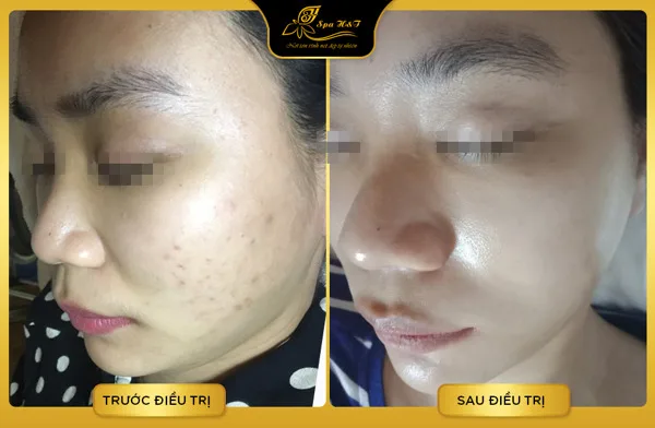 địa chỉ làm trắng da mặt tphcm